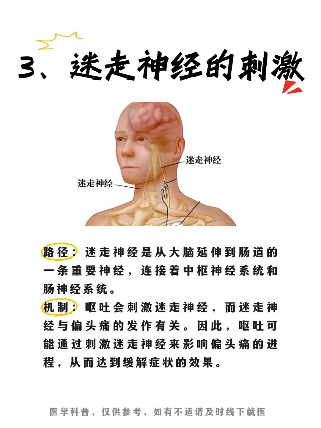 为什么偏头痛一定要吐一场才能够缓解一、颅内压降低原因：偏头痛发作时，可能会导致颅