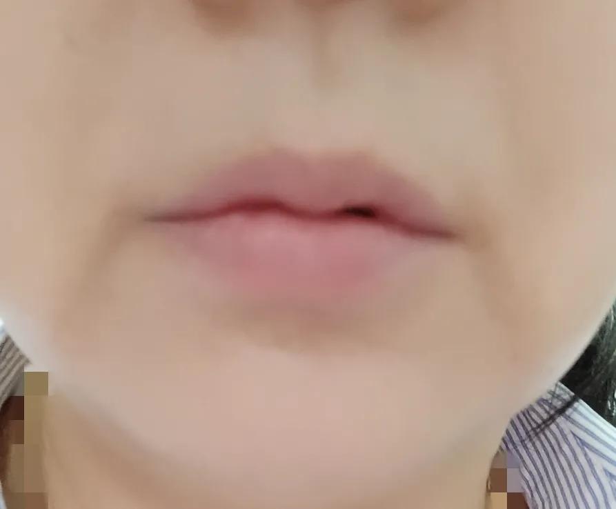 今天突然发现，女人长了唇纹特别，特别的显老，有了唇纹的女人，看上去就是老人家了，