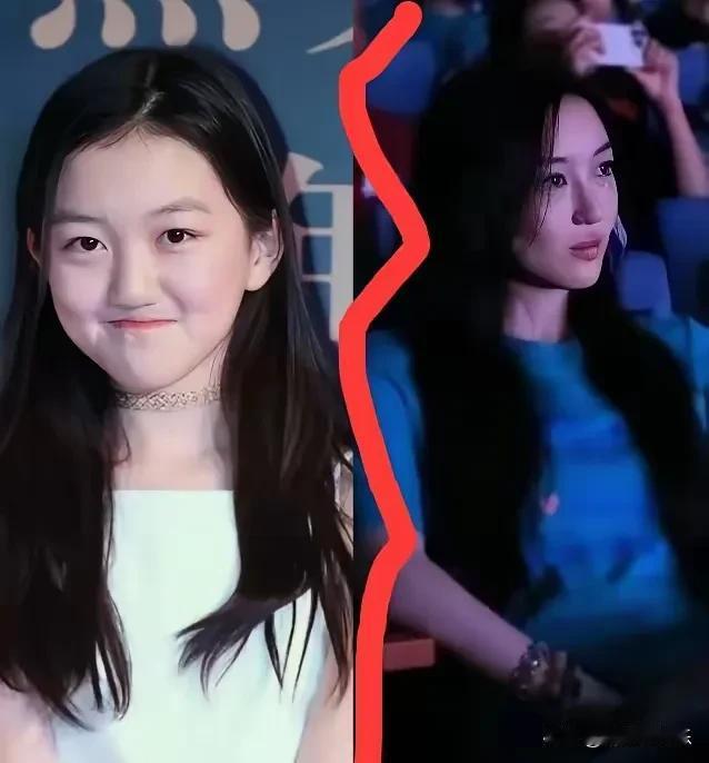 这真的是李嫣吗？
兔唇修复得一点痕迹也没有了，
而且上唇唇形还非常漂亮，
难怪去