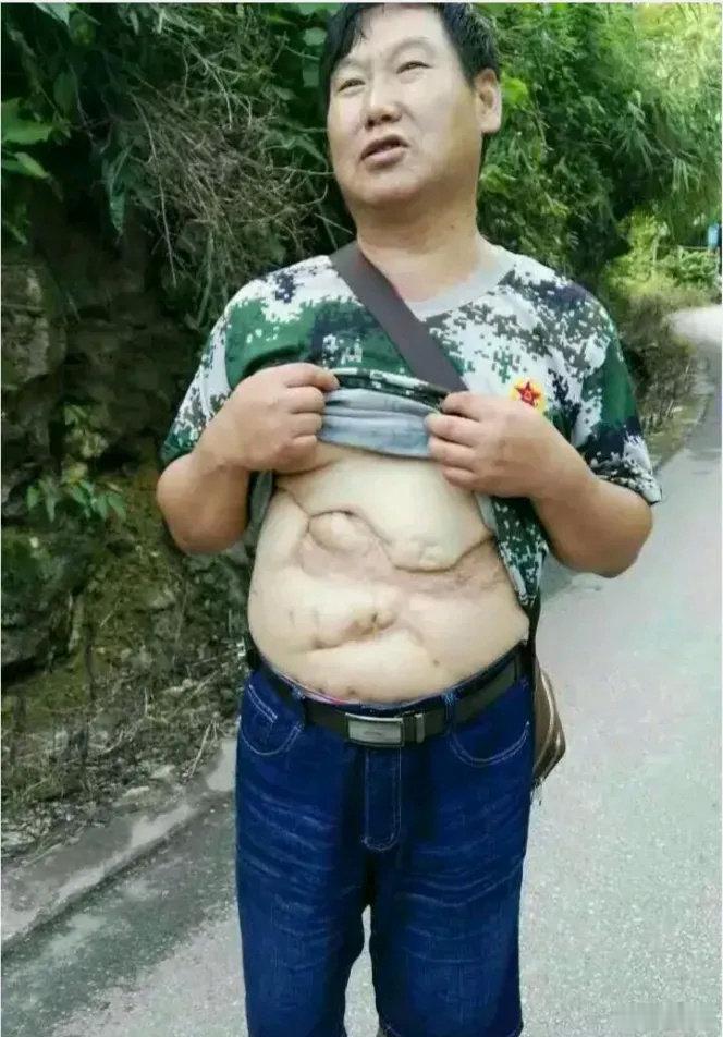 他把衣服掀起来的那一刻，肚皮中的"地图"让人感到震撼！他就是老山某炮团二营副营长