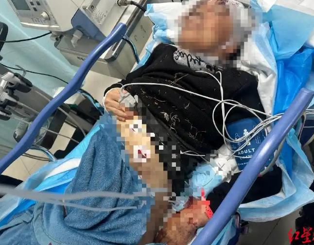 “必须严惩！”吉林长春，62岁老人在徒步时，突然被从附近院子冲出的7只大狗扑倒。