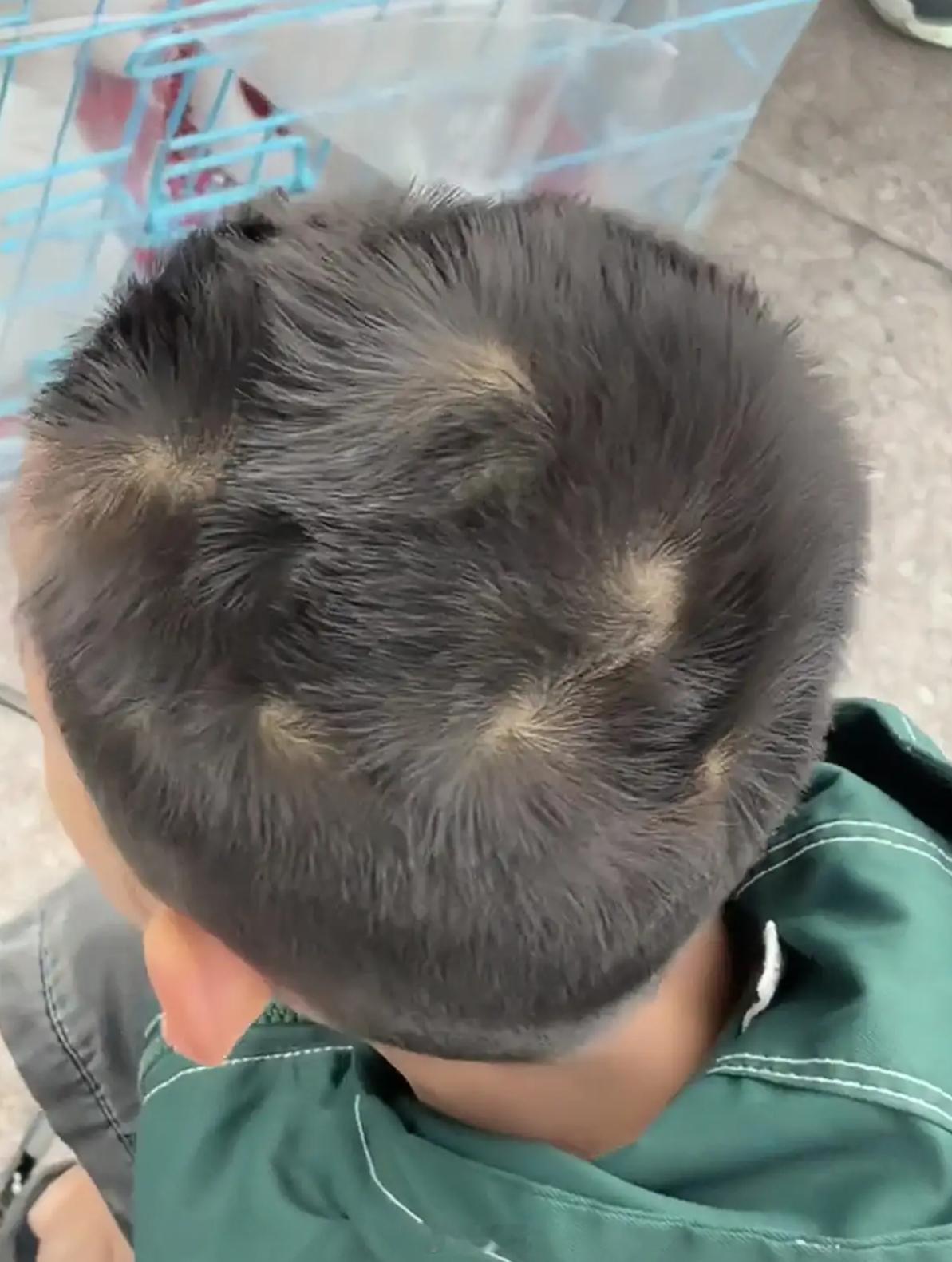 孩子的头顶这多个漩涡，有什么说法吗？ 