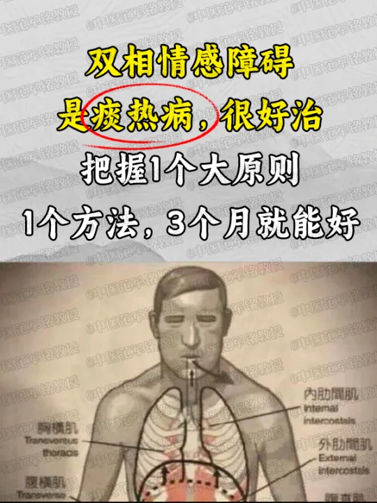 双相情感障碍，是痰热病，很好治，把握1个大原则，1个方法，3个月就能好...