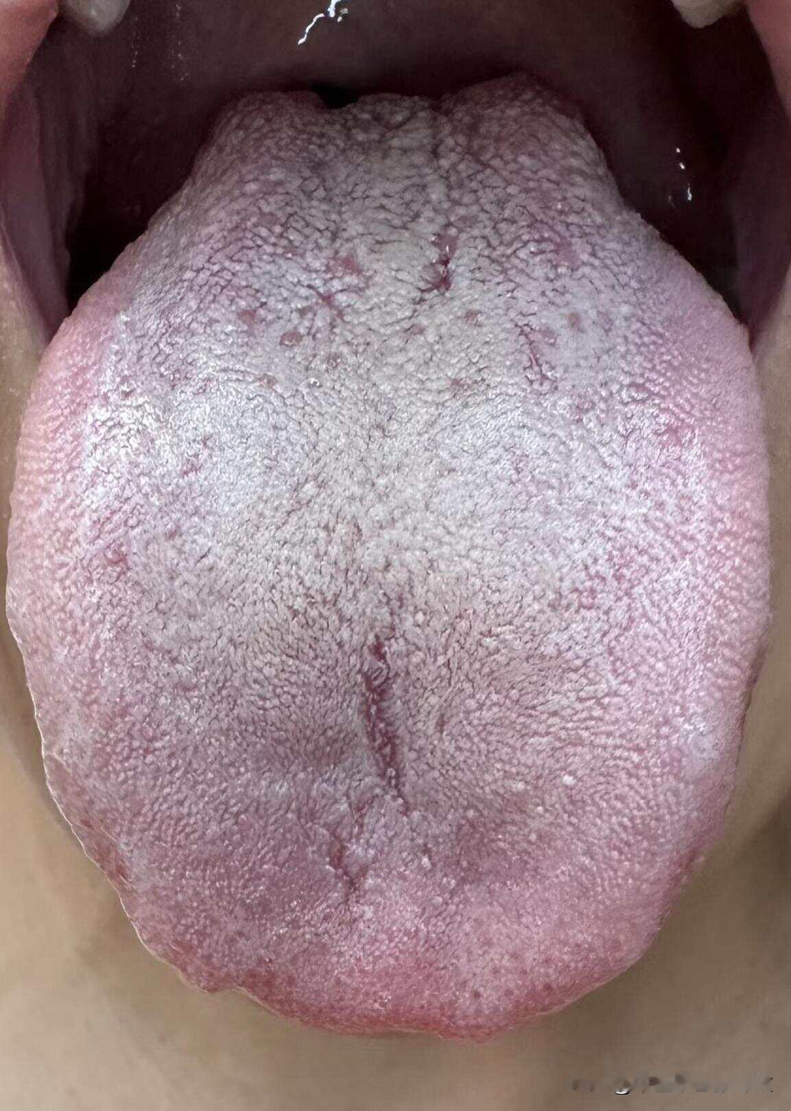 小兄弟，听我一句劝，赶紧停手吧[给力][给力][给力]
门诊患者，27岁，还没结