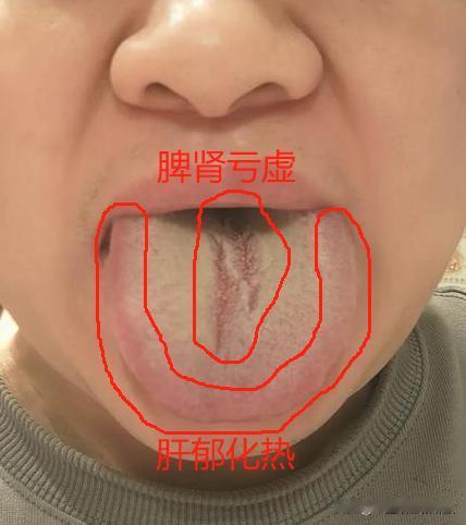 这舌头，给我整的都挺无语的，这裂纹也太。。。。[笑哭][笑哭][笑哭]
最近怎么