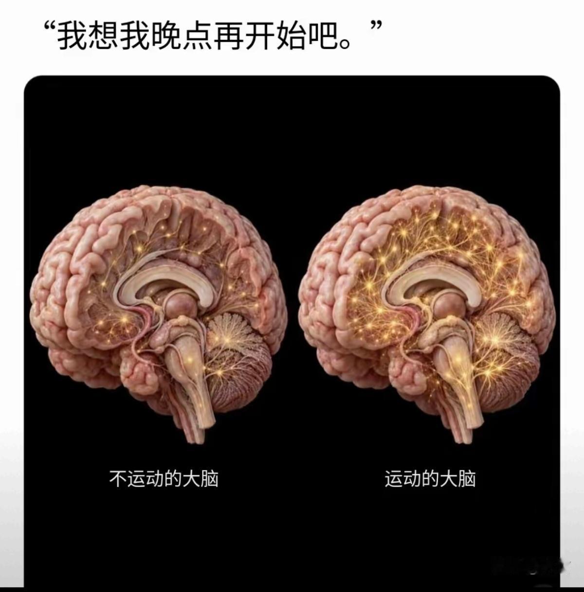 运动后大脑就会想出很多金点子。