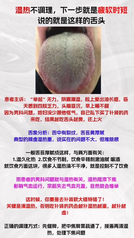 湿热不调理，下一步就是“疲软，续航短”，说的就是这样的舌象


#养生##中医#