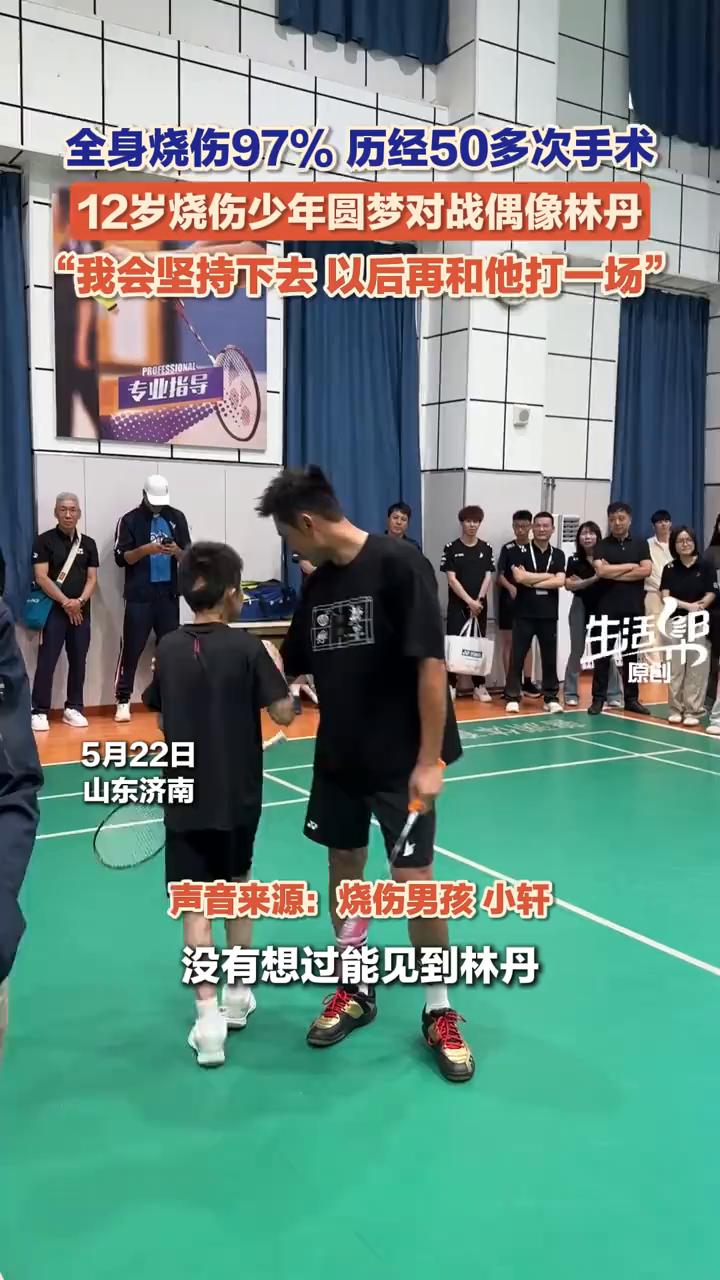 全身烧伤97%，历经50多次手术，12岁烧伤少年圆梦对战偶像林丹。
生活帮。
5