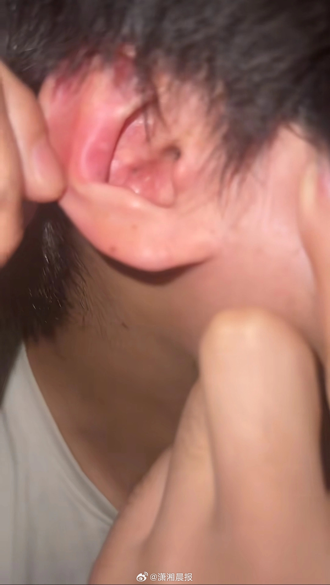 【#大学生称睡觉时蓝牙耳机爆炸#，#有商家认为蓝牙耳机风险是劣质配件#】6月10