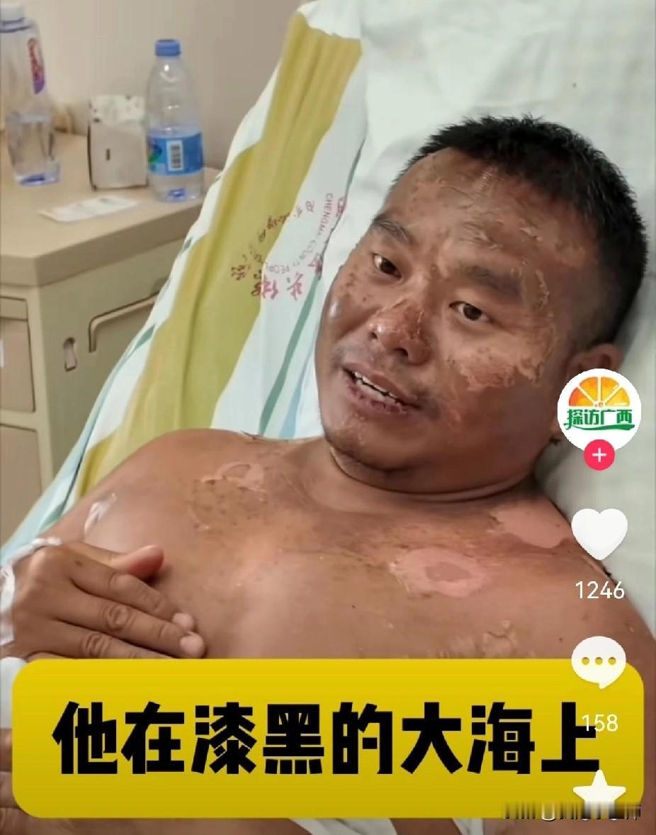 “他的命太硬了！”
几十亿分之一的生还几率，
被这个男人死死抓住了，
简直比中头