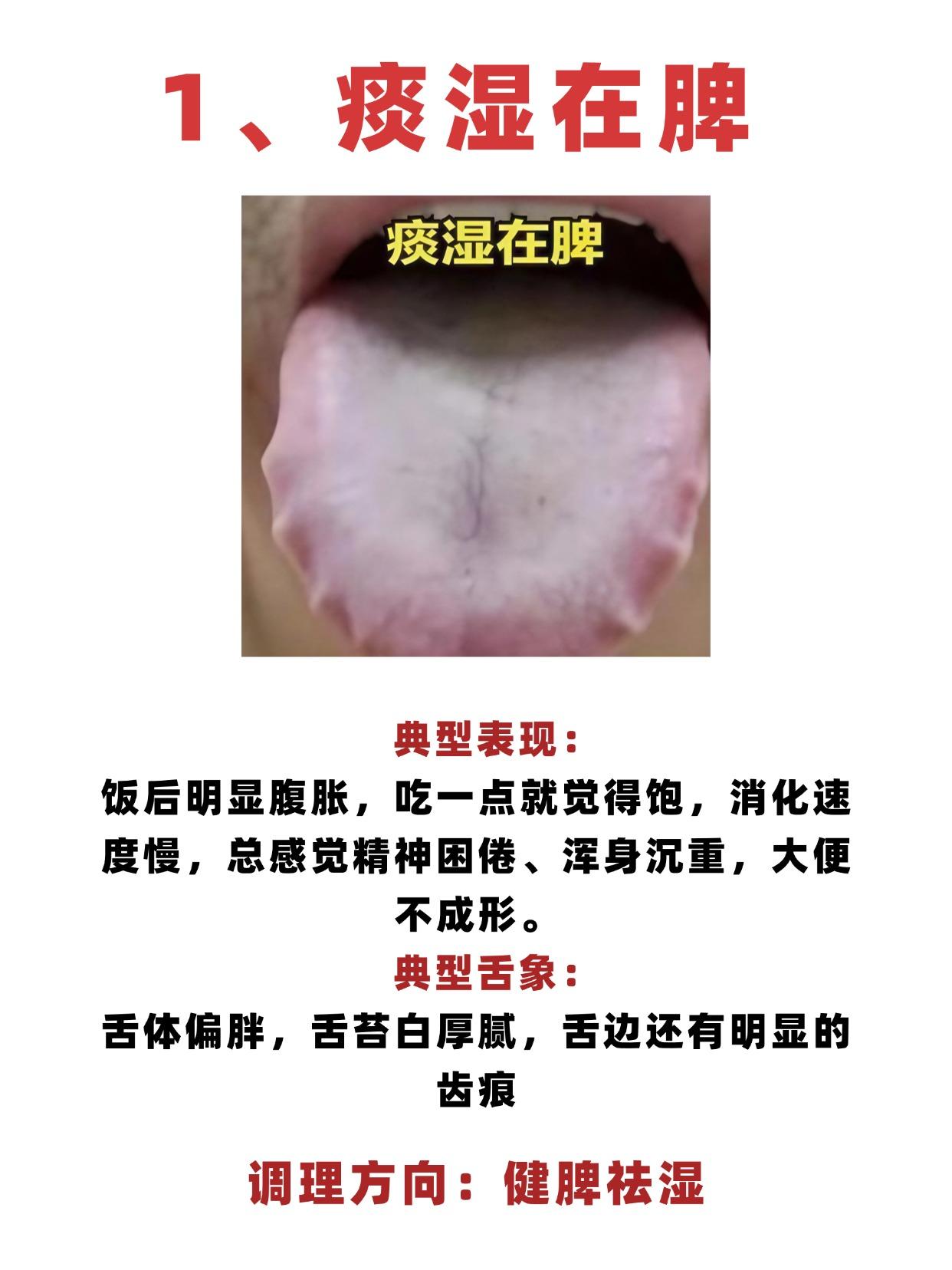 痰湿在脾，痰湿在肺，痰湿在肝，痰湿在肾。教你一招，从头到脚清干净！