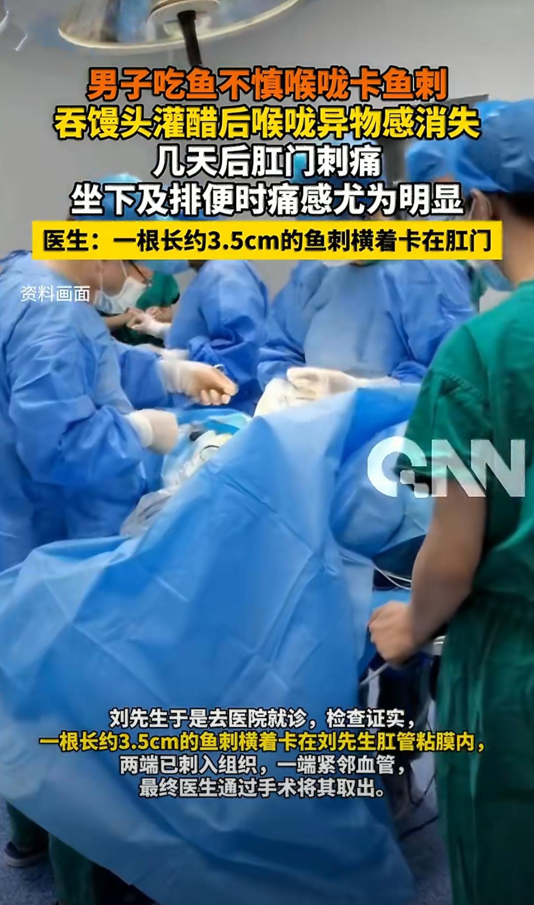 有位45岁的先生吃鱼时被鱼刺卡了喉咙，他没去医院，而是用了大家常说的老办法，连着