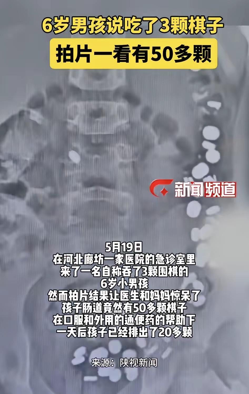 太揪心！河北6岁男孩谎称只吞了3颗棋子，拍片查出50多颗，带过孩子的家长都清楚，