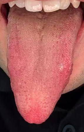 精血亏虚 + 气机不畅，宗筋失养该如何科学调养？







对于男同志而言并