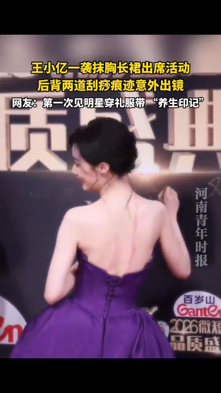 王小亿一袭抹胸长裙出席活动，后背两道刮痧痕迹意外出镜。
网友：第一次见明星穿礼服