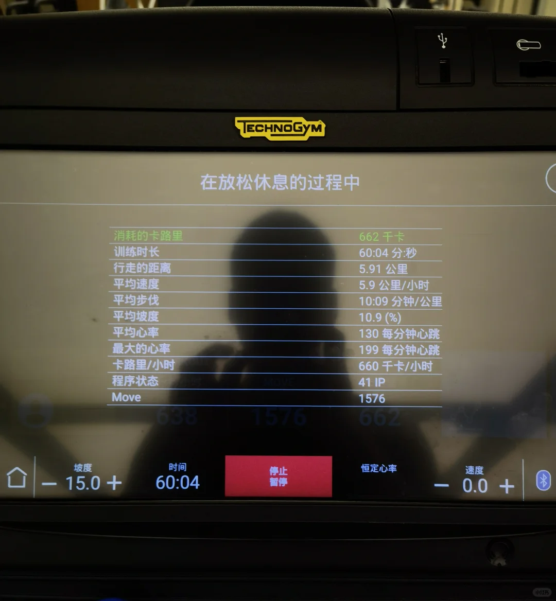运动日常‖跑步机