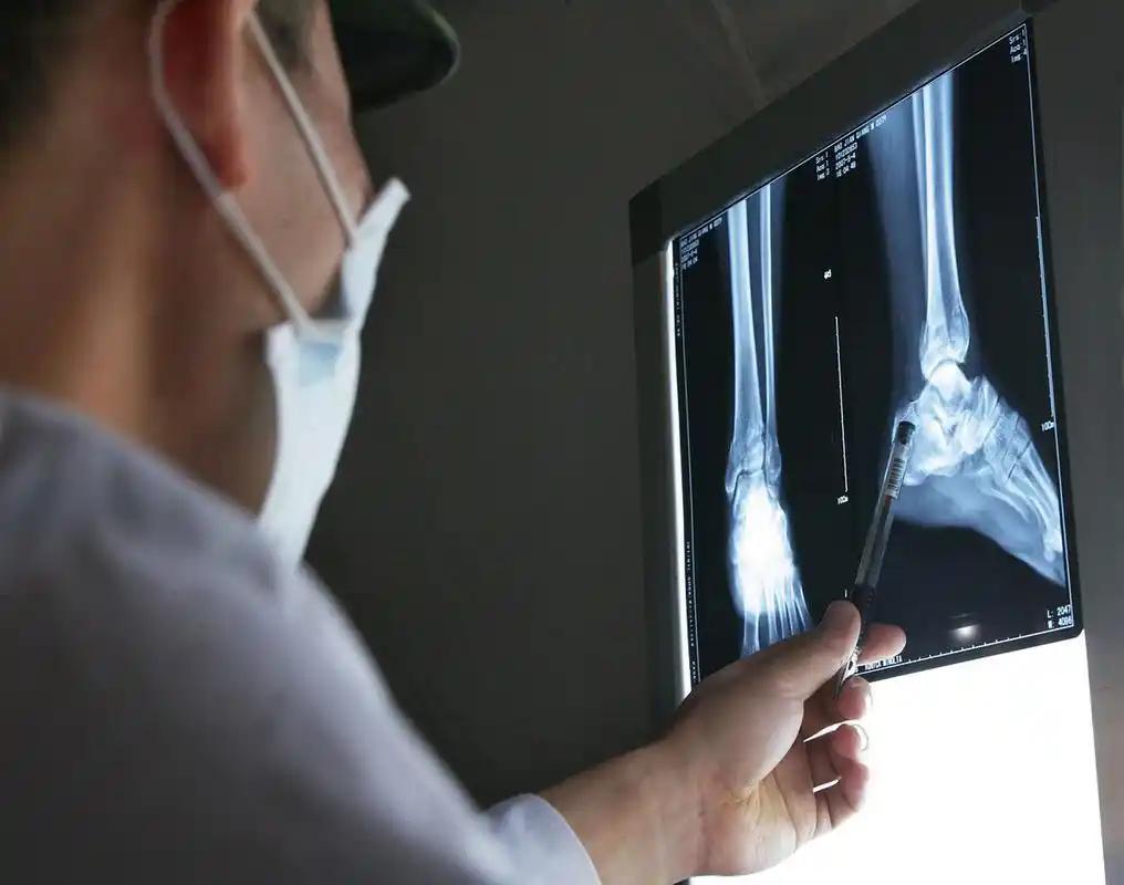 6种癌症骨转移率超90%！医生提醒：出现这6大症状已到高危期！

近年来，随着医