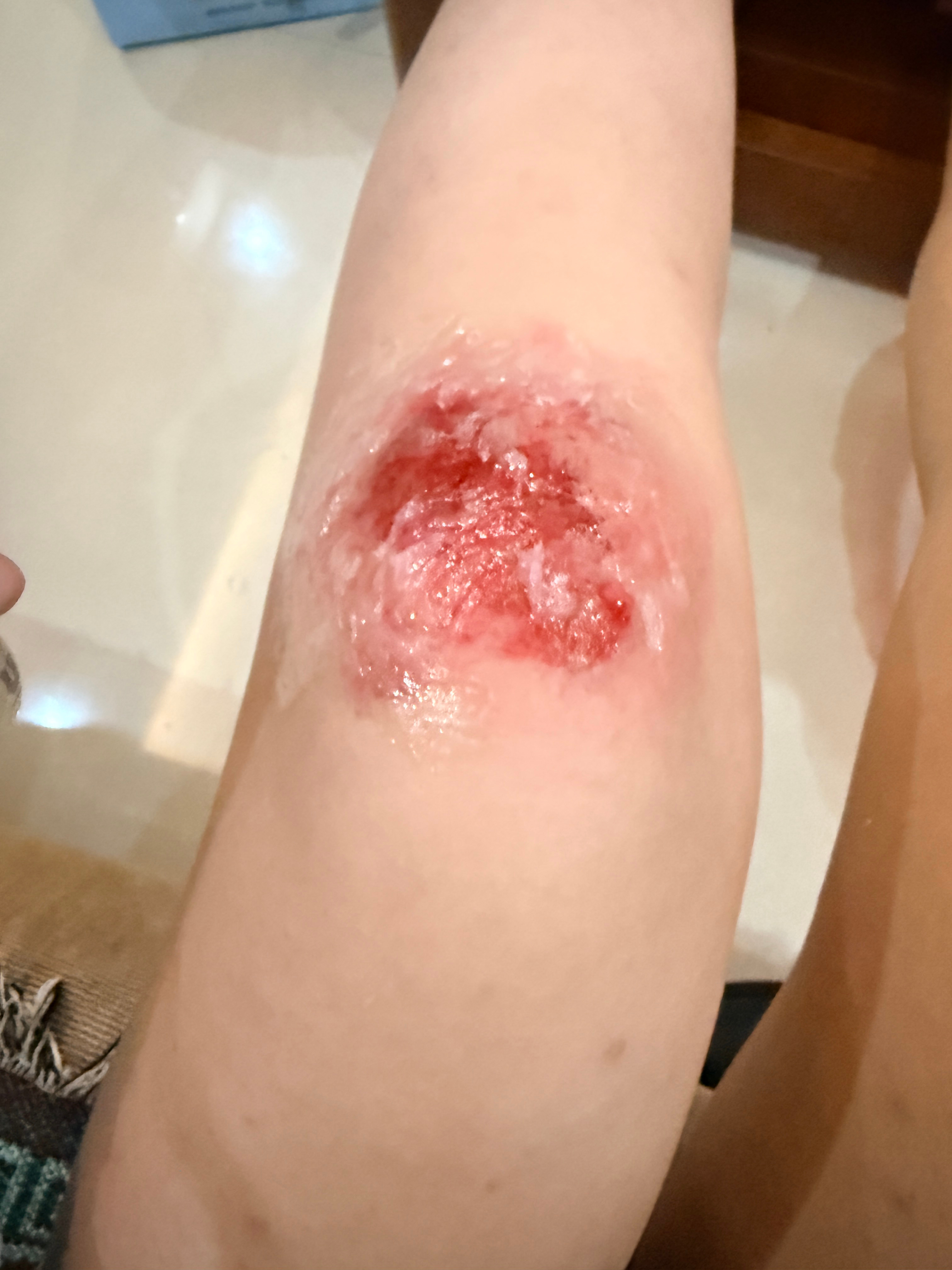 有没有什么仙术能保佑我不受伤 痛得我哭两天了 几个朋友压着才给我强上药 没忍住洗