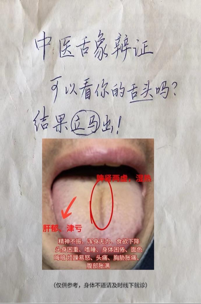 中医舌象辩证，可以看看你的舌头吗？结果立马就出#中医 #舌诊 #医学科普 #调理
