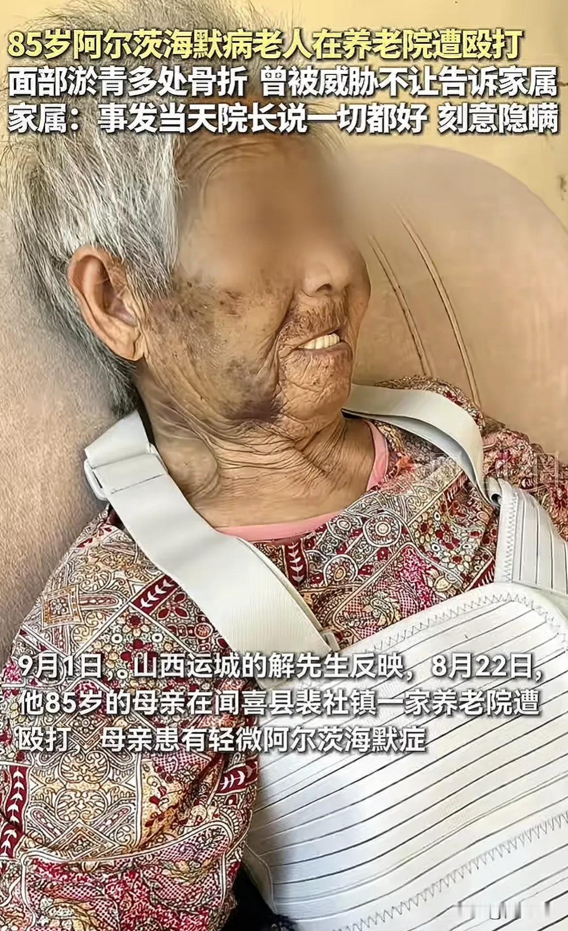 山西运城，85岁老母亲住在养老院，被人打得浑身伤，疼得受不了，她悄悄借别人手机打
