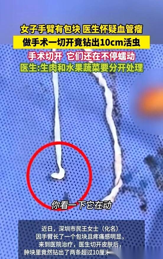 医生一刀划开，两条十几厘米的活虫，就从那女的胳膊里钻了出来。
真的，活的。还在蠕
