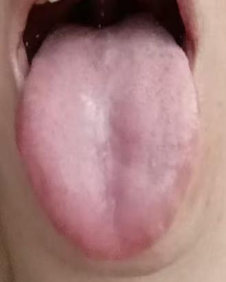 身体表现大不如前，实证虚证区别调养，改善海绵体内在状态






很多男士朋友