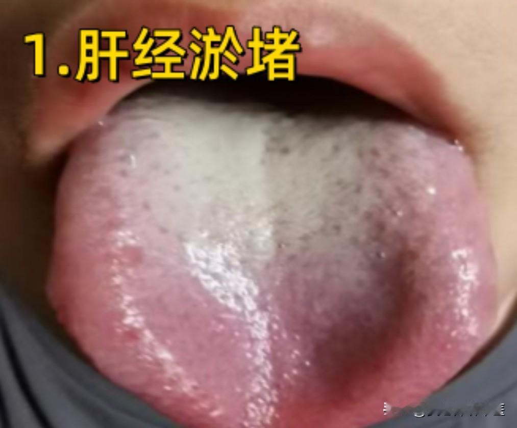 男人能力差，可能不是肾虚，而是这3处堵了！

1、肝经淤堵
辩证：肝主疏泻，气机