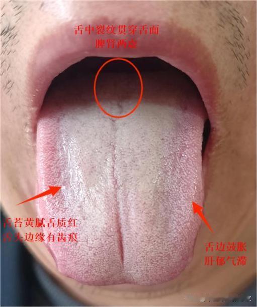 劳动节不是让你这样劳动的，身体都这样了，别想这想那了，忍一忍吧[泣不成声][泣不