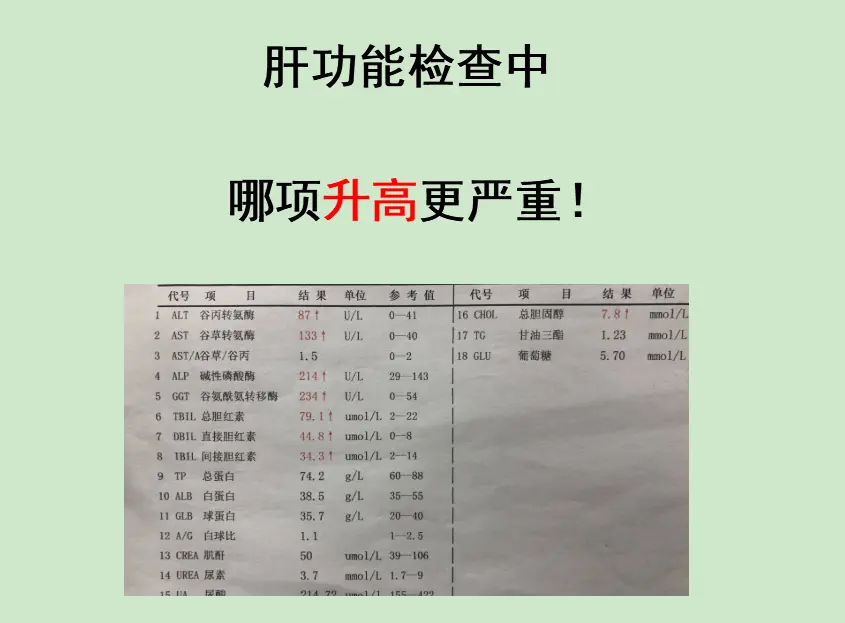 肝功能哪项升高更危险？ 很多患者拿到肝功单子，只盯着转氨酶看，以为这项...