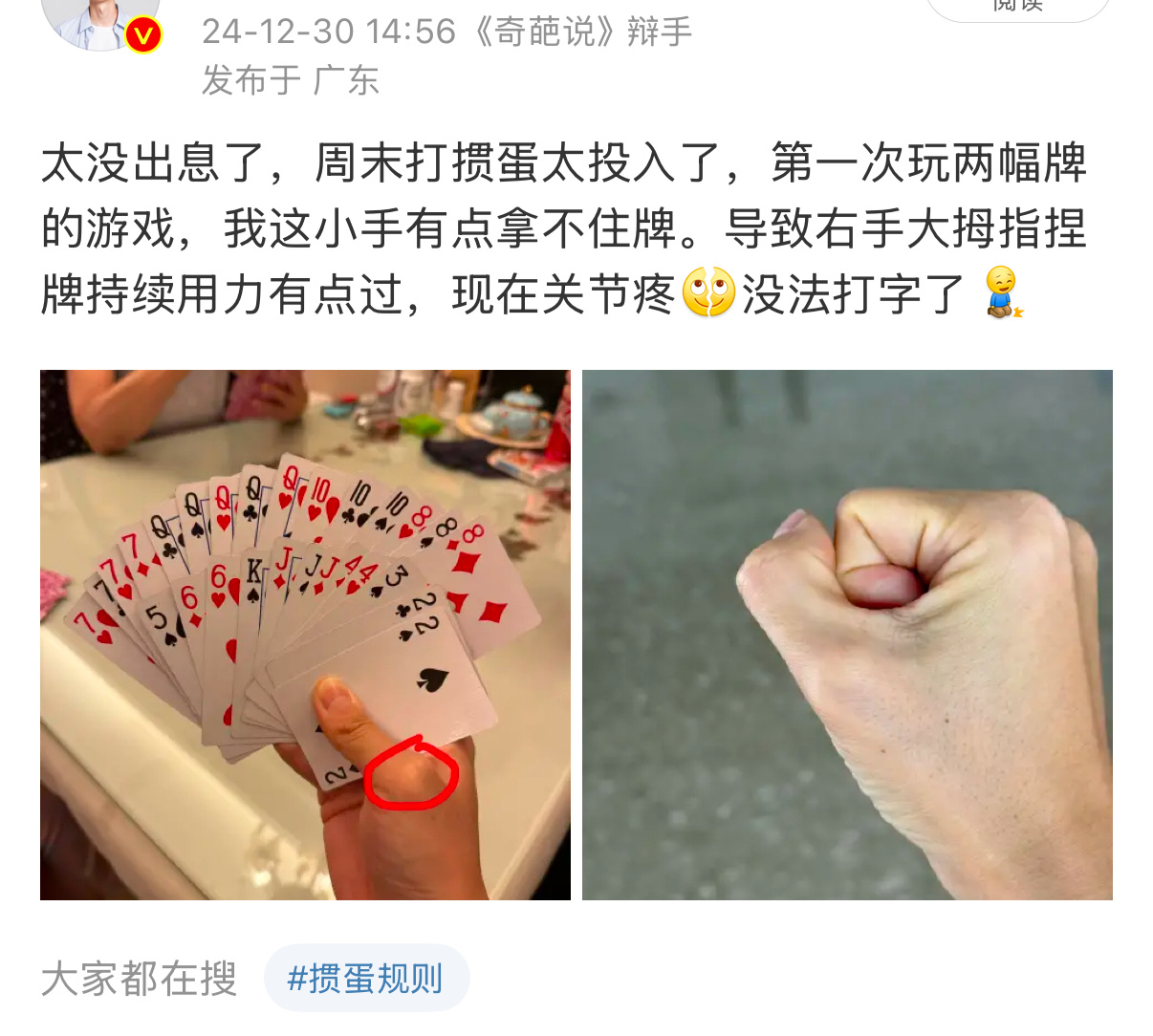 上周玩掼蛋太投入，结果大拇指关节受伤了[跪了]我扭头就去买了个拿牌器，还能立在桌