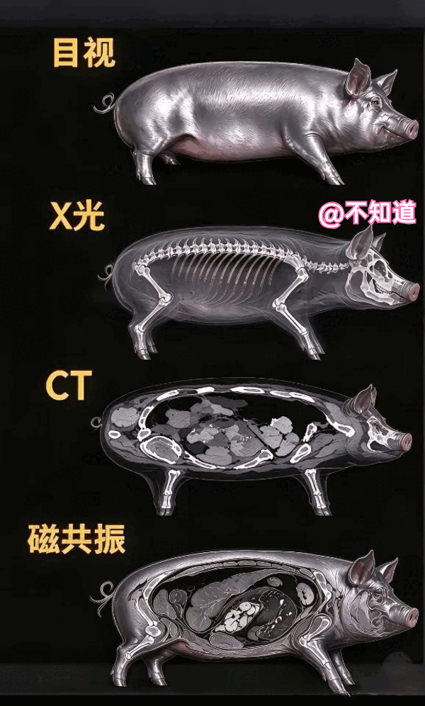 终于知道
为啥磁共振
那么费钱了