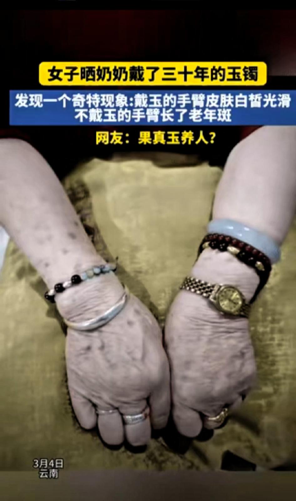 云南一位女子在网上分享了一段真实视频，她和奶奶日常聊天时意外发现，奶奶手腕上戴了