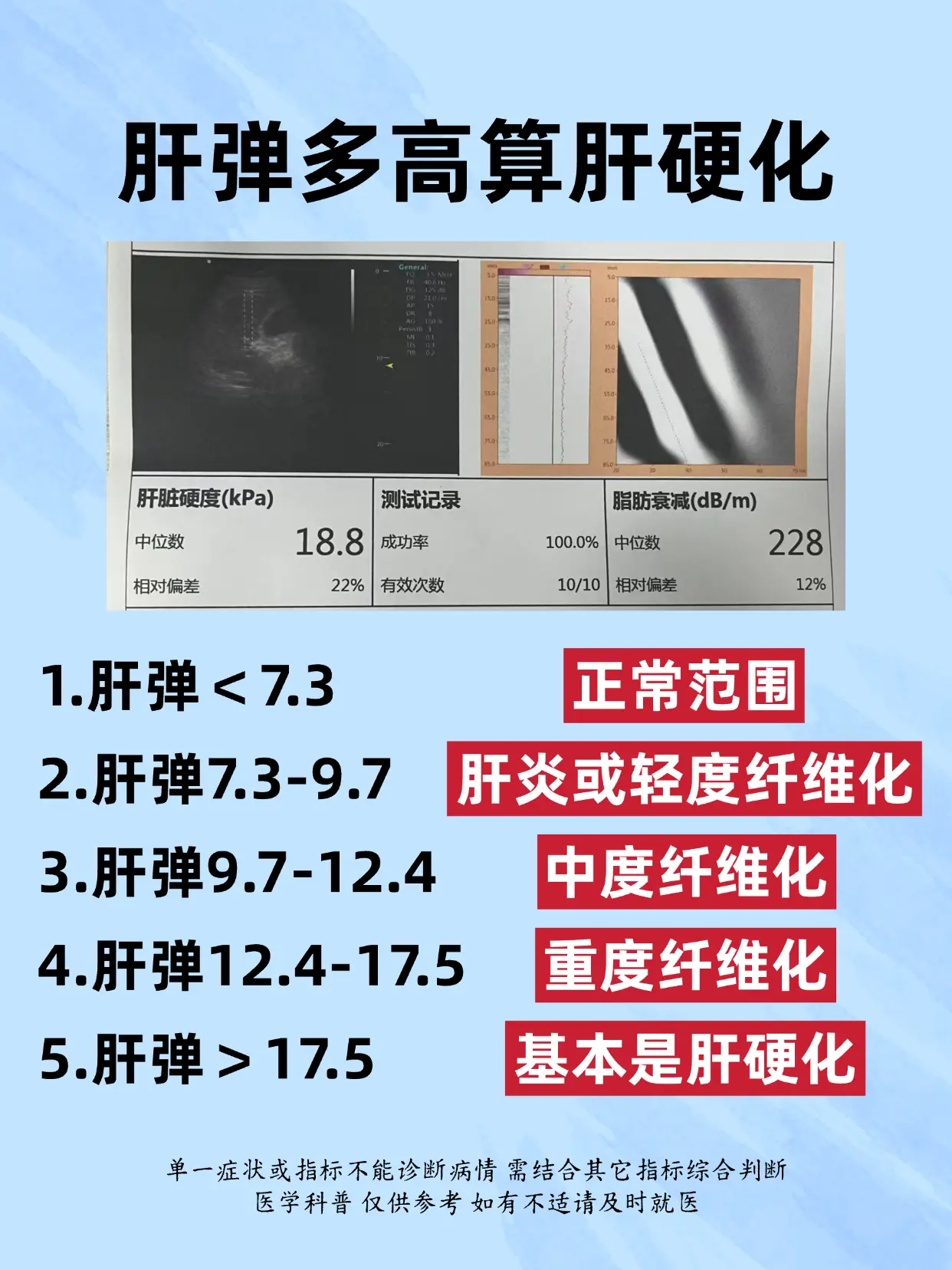 肝弹多高算肝硬化。