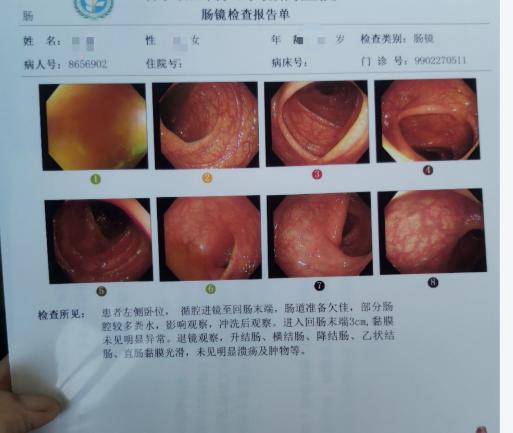 45岁还没做过肠镜？别等到有症状再行动，那时候可能已经晚了！
45岁，是人体健康