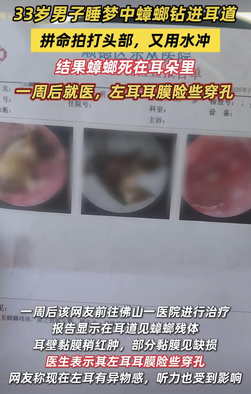 广东一位网友夜里正睡得香，突然感觉耳朵里不对劲蟑螂钻进去了!他慌了神，又是拍又是