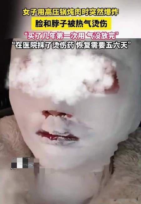 惊魂！女子高压锅炖肉突爆炸

近日，一女子用高压锅炖肉时遭遇惊魂一幕。她见锅盖上
