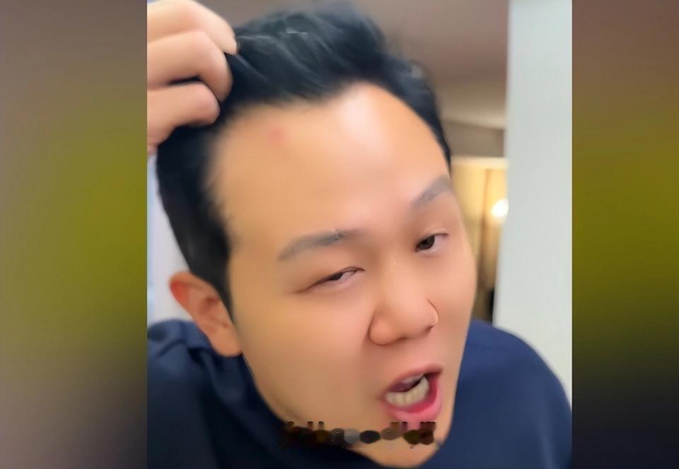 中国球迷墨西哥惊魂12小时！

落地半小时枪顶脑门，遭“飞车党”抢劫，劳力士、现