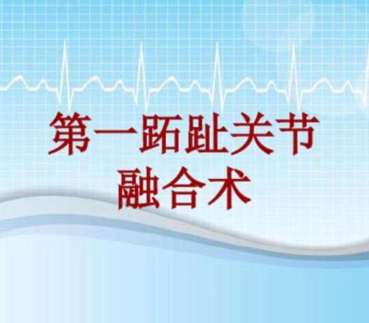 关于关节融合治疗拇外翻
