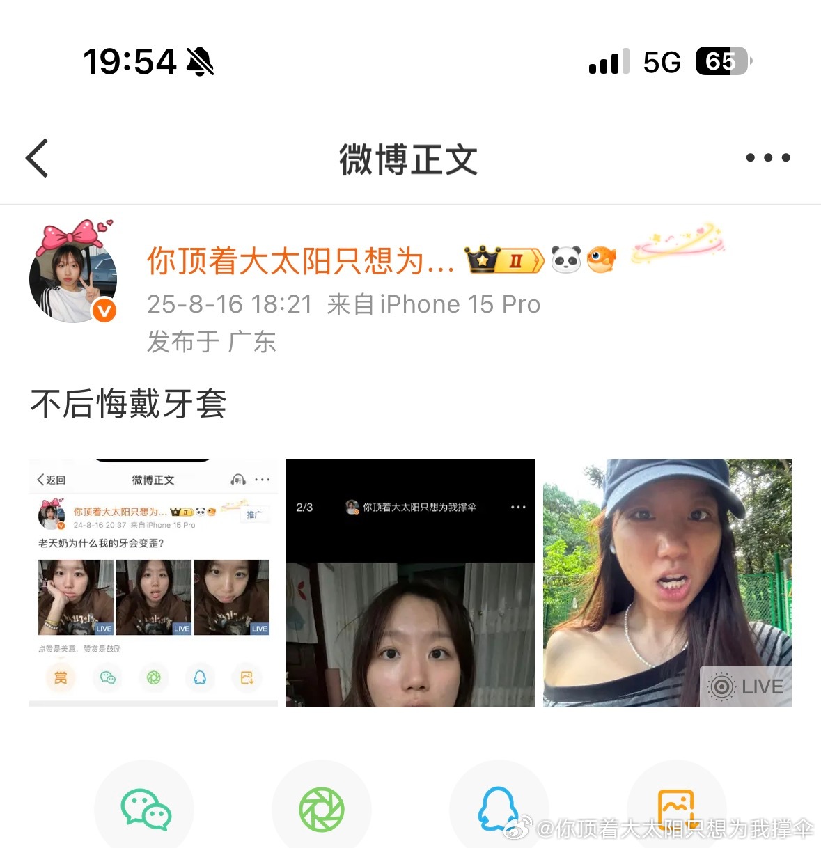 去年今日，马上就可以结束牙套啦！！ 