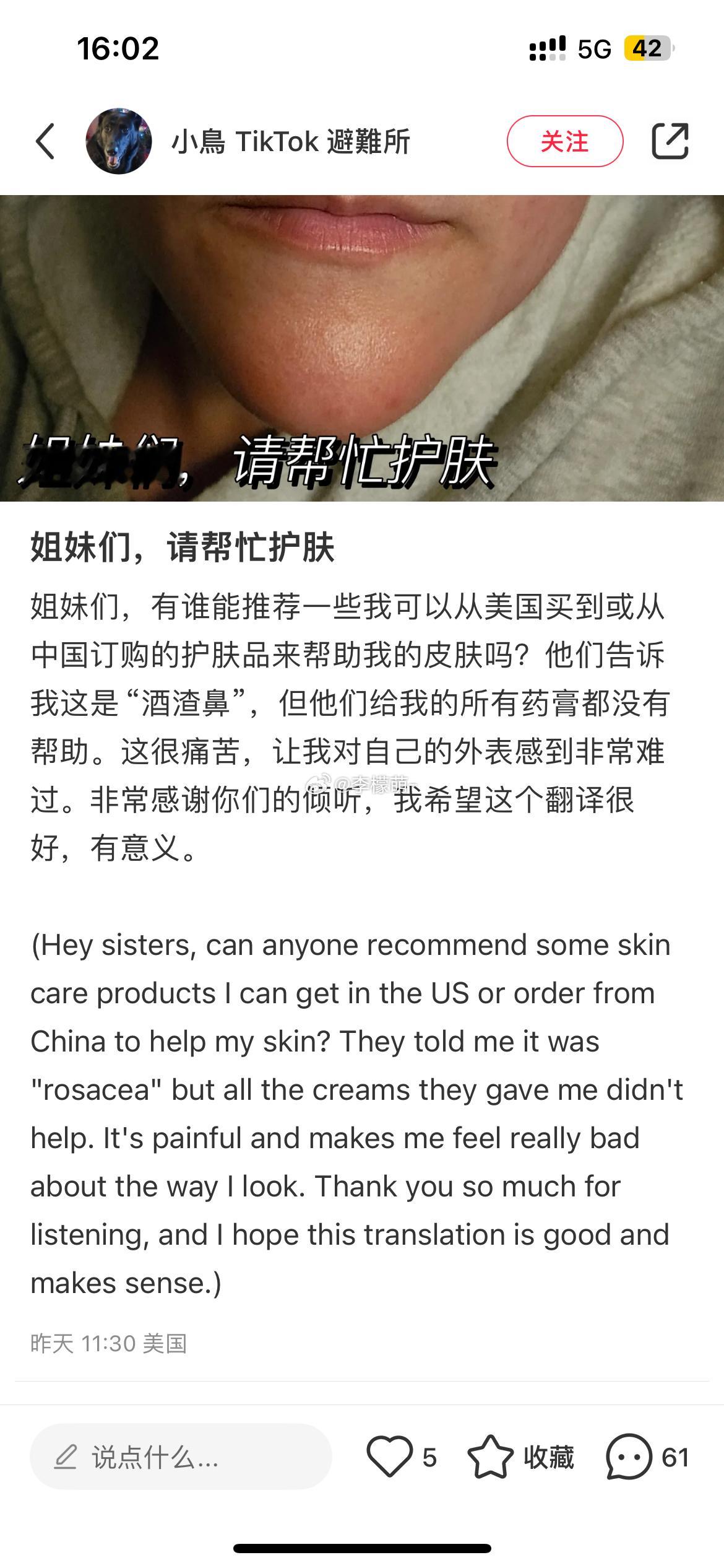 开始到美容了[doge] 