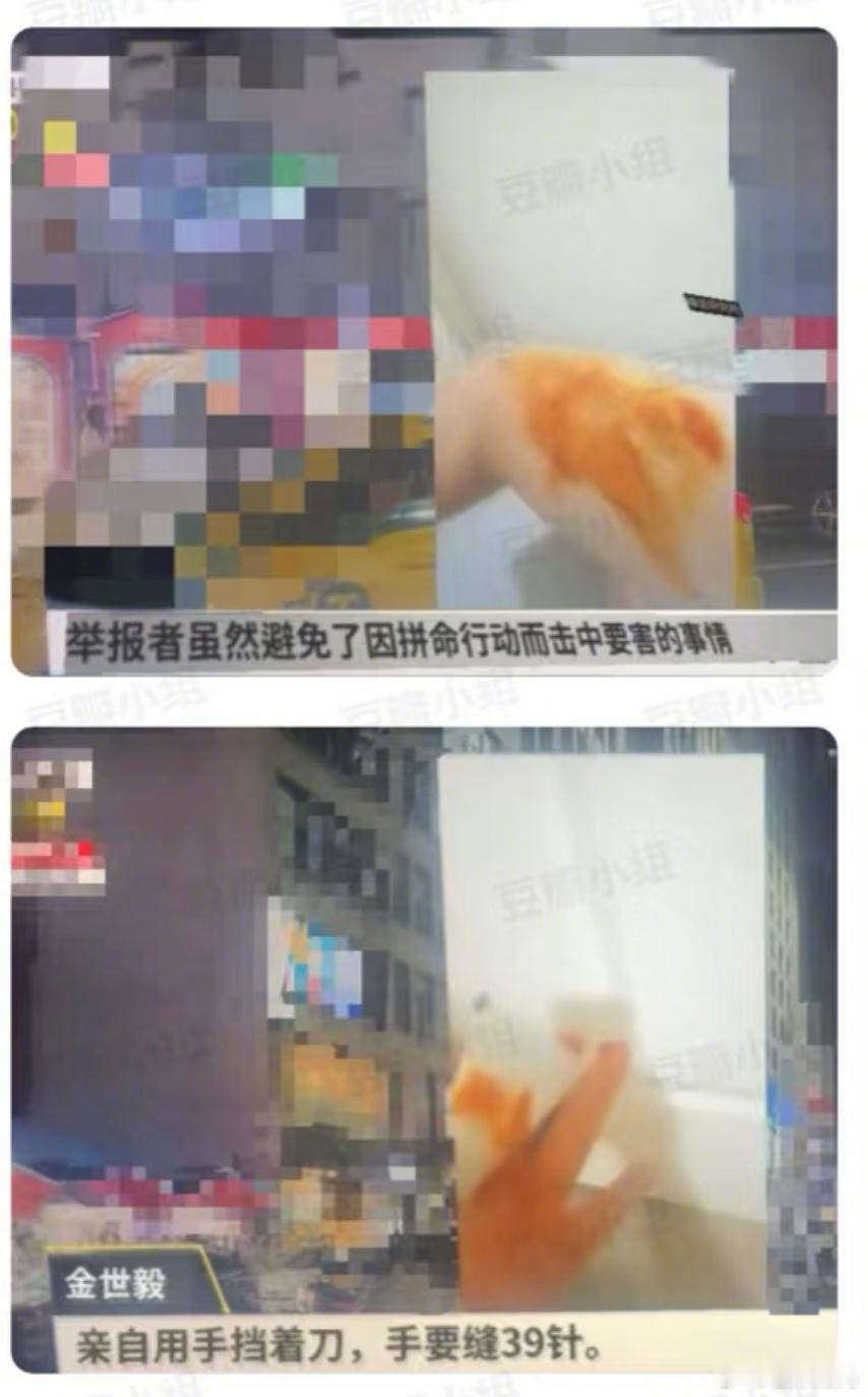 金秀贤举报人遭歹徒袭击举报人发了一个自己受伤的视频，说要缝很多针😰这发展走向太