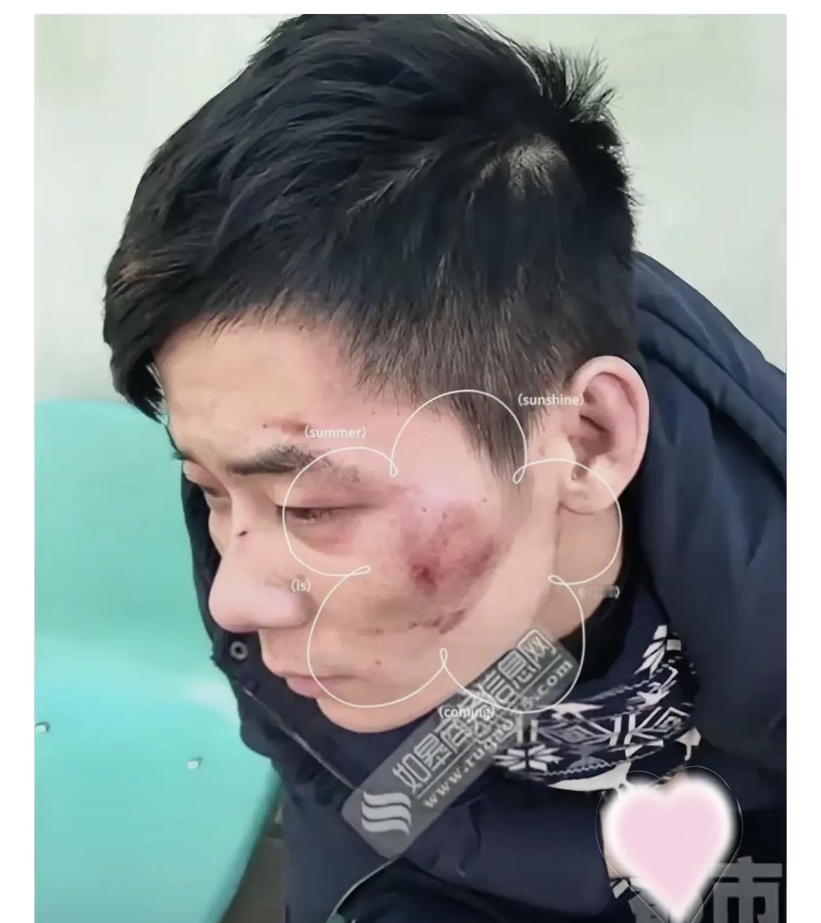 大半夜被一群人死命追着打，这大哥干了件最聪明的事——直奔武警大门

5月10号凌