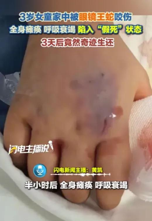 这场意外，真的是最惊心动魄的“假死”！

云南一个3岁小女孩，在家玩时被眼镜王蛇