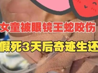 云南3岁女童被眼镜王蛇咬伤"假死"3天：她不是昏迷，是被锁在身体里的清醒！
 