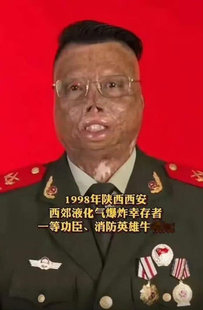 消防英雄牛相成!舍生忘死救人荣立一等功，烧伤面积达97%。向英雄致敬！ ​​​