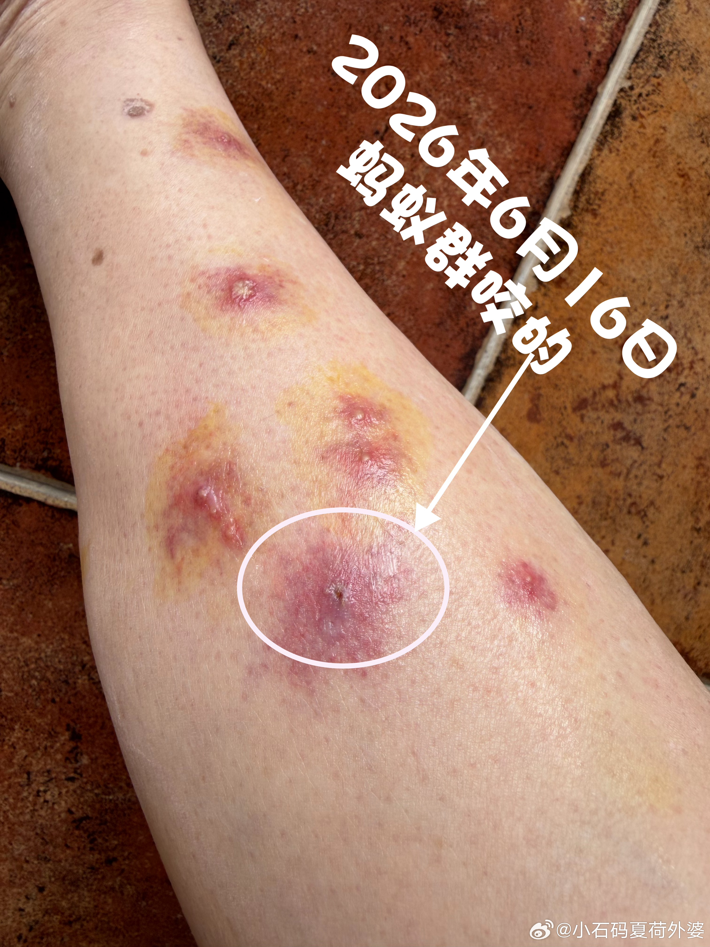 水培随笔《红白喜事》写于2017年6月17，有些朋友未读，重发出来，珍爱生命，珍