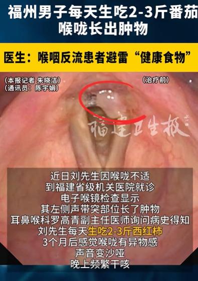 “解释不清了！”福州，60岁男子听说番茄营养高，于是每天生吃2-3斤番茄，结果，