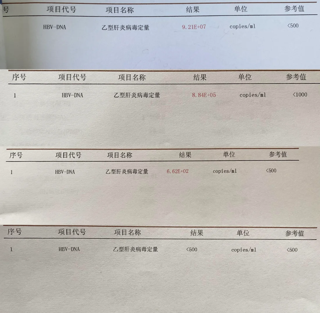病毒量是导致肝损伤的直接因素！