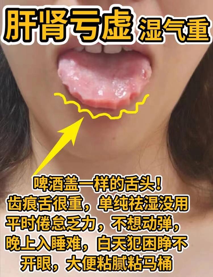 计划分享100个舌照片，一起学习舌诊[比心][比心][比心]
今天先出场10位病