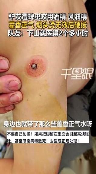 我跟你说，最吓人的根本不是被虫子咬，而是那帮兄弟们“救”他的时候。
眼睁睁看着那